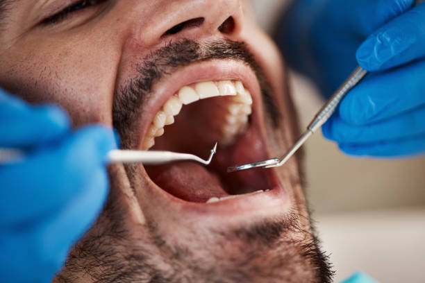 Best Chipped Tooth Repair Near Me  in La Homa, TX