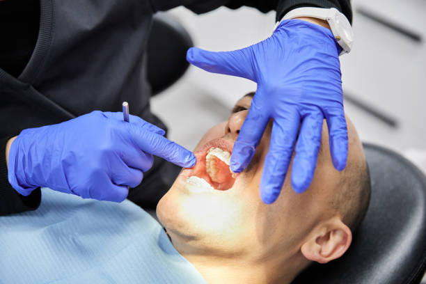 Best Emergency Gum Pain Relief  in La Homa, TX